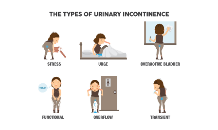 urinary incontinence